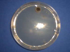 petri dish bacteria growth