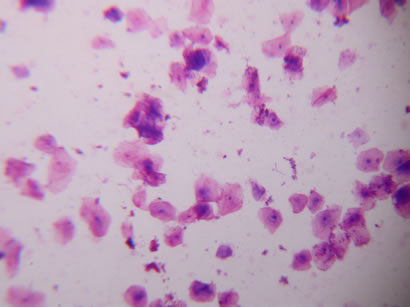 Bacteria From Mouth 111