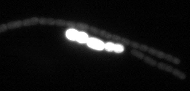 epifluorescence view of akinetes