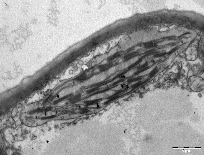 chloroplast