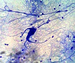 neuron
