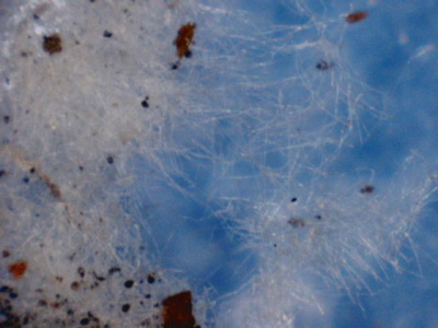 fungal hyphae