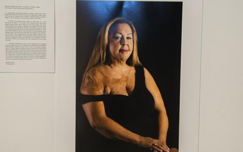 Viewpoint student Rachel Jacobson used archival pigment print to create &quot;Yolanda,&quot; a portrait of a 43-year-old burn survivor. Photo by Nestor Garcia.