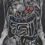 Human Intestinal MIcrobiota